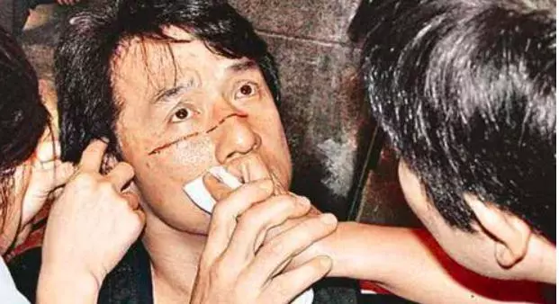 64歲成龍走路要拄拐,腳傷嚴重需手術,卻一直拖延治療時間,原因..