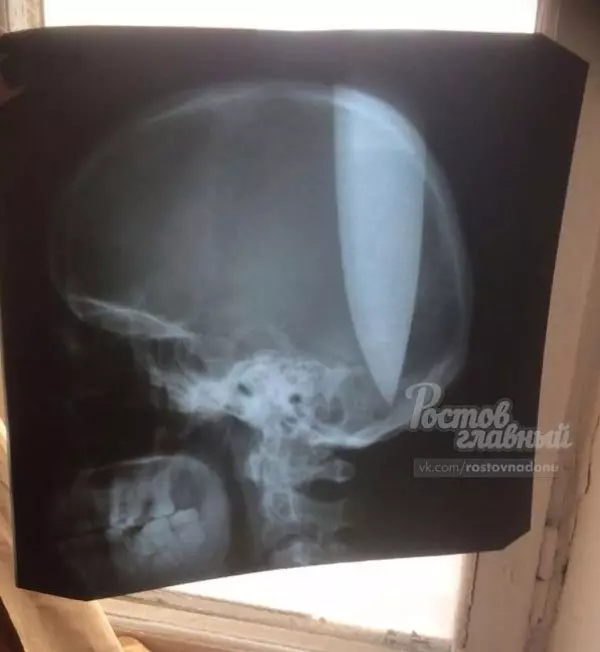 鼻塞好痛苦! 俄男拿長刀插頭求空氣