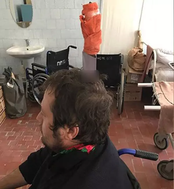 鼻塞好痛苦! 俄男拿長刀插頭求空氣