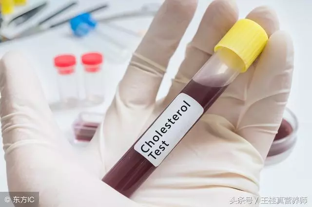 血脂高?不吃肉就能避免?別想的太好了,這些食物也能引起血脂高