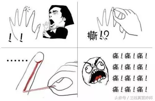 手指上有倒刺,您可以別再直接撕掉,已經有人因此而截掉手指
