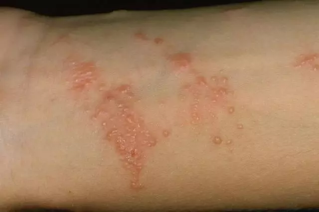 這名醫生逃過一劫,5歲女孩卻沒了命……這個教訓每個人都值得看