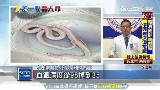 台中溪南消防分隊隊員,整理隊上蛇龍遭罕見白雨傘節咬休克 20年專家也未見過