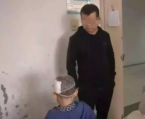 (氣憤!5歲男童熟睡中竟被爸爸懷孕女友毒打,鎚子猛擊,傷口深見頭骨!)