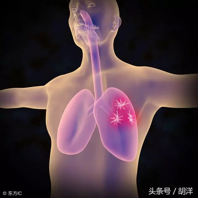 前半生吸菸,後半生吸氧,這句話到底是不是真的,醫生說出大實話