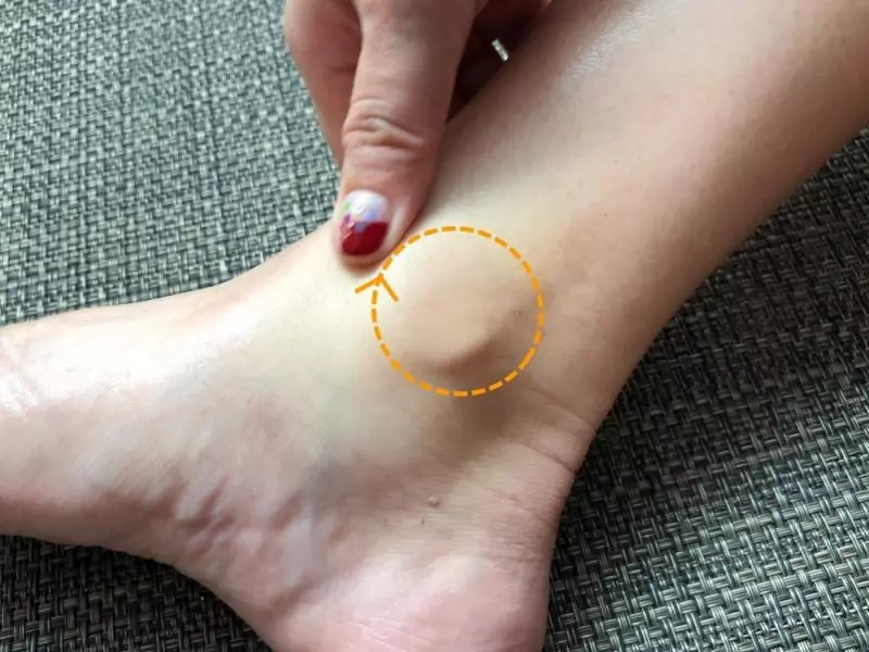 每到下午腳就腫了一圈,解救腫腫腿的超簡單居家按摩得馬上學起來