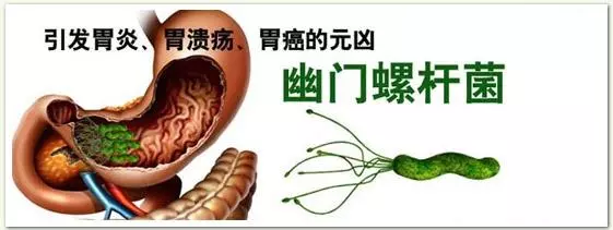 幽門螺桿菌危害有多大?如何判斷幽門螺桿菌是否被消滅乾淨了?