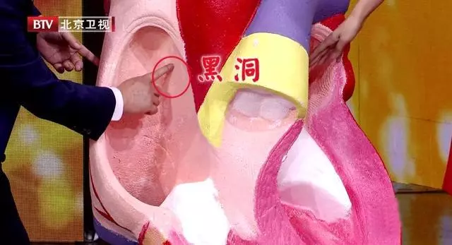 18歲男孩突發腦梗,竟是因為有「心眼」!很多人都有,只是不知道