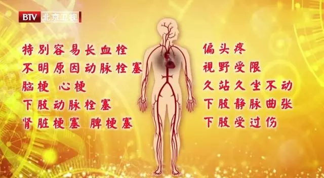 18歲男孩突發腦梗,竟是因為有「心眼」!很多人都有,只是不知道