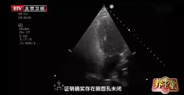 18歲男孩突發腦梗,竟是因為有「心眼」!很多人都有,只是不知道