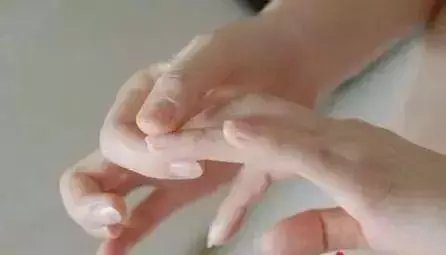 腦血管崩潰前有10個信號,大部分人都忽略了