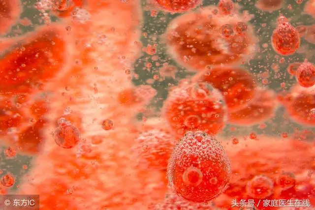 常吃這6種食物,能把血脂「洗」得很乾凈!建議高血脂患者多吃