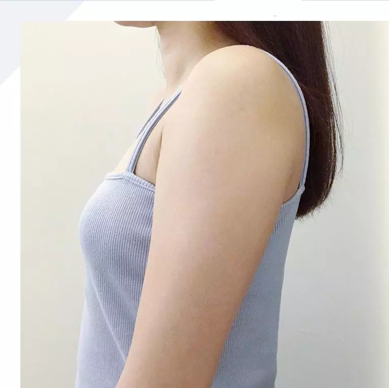 一個月瘦下最難瘦的手臂,「天鵝臂」練習到底有沒有用?
