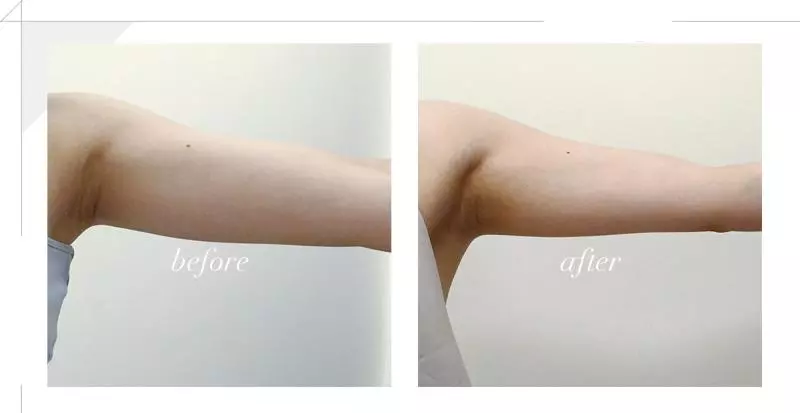 一個月瘦下最難瘦的手臂,「天鵝臂」練習到底有沒有用?