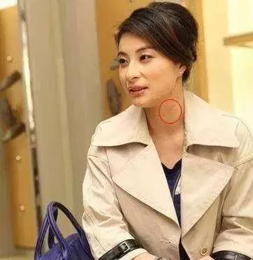 激情過度「留吻痕」的6位女星,而最後一個未婚也有?太尷尬…