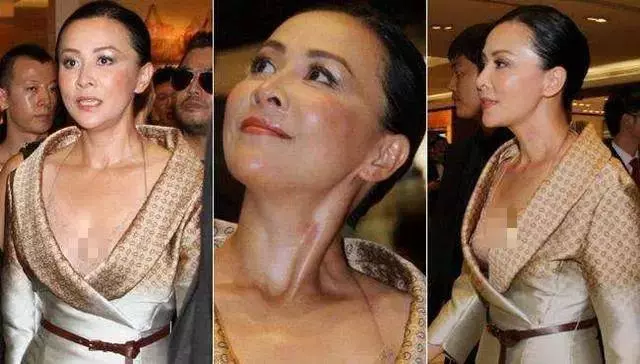 激情過度「留吻痕」的6位女星,而最後一個未婚也有?太尷尬…