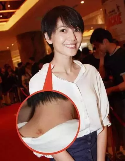 激情過度「留吻痕」的6位女星,而最後一個未婚也有?太尷尬…