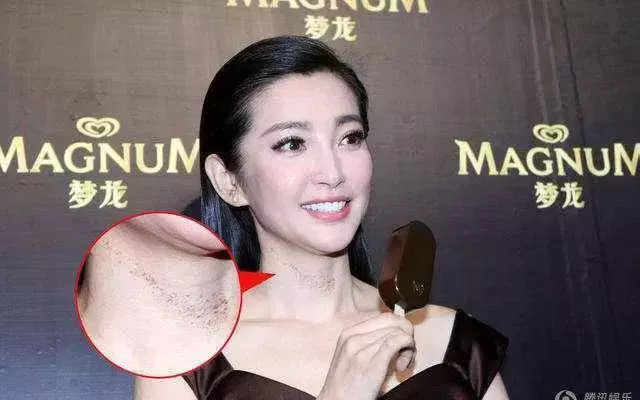 激情過度「留吻痕」的6位女星,而最後一個未婚也有?太尷尬…
