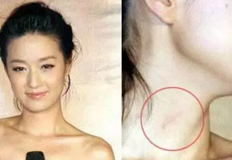 激情過度「留吻痕」的6位女星,而最後一個未婚也有?太尷尬…
