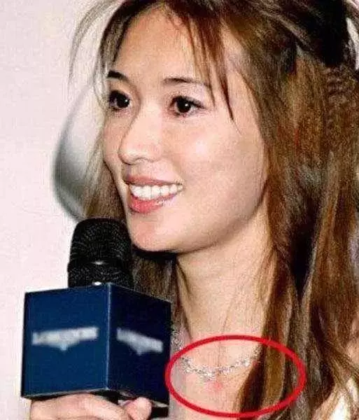 激情過度「留吻痕」的6位女星,而最後一個未婚也有?太尷尬…
