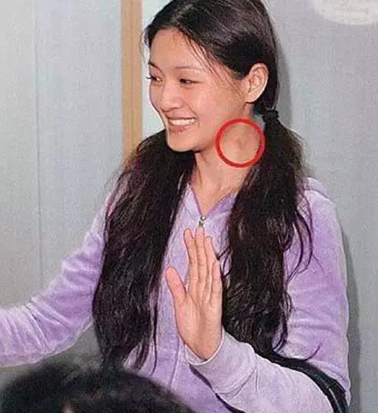 激情過度「留吻痕」的6位女星,而最後一個未婚也有?太尷尬…
