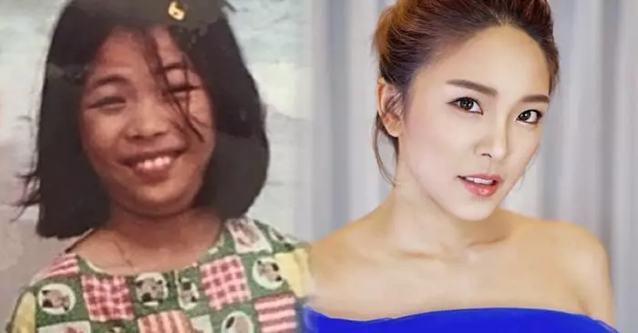 醜小鴨變天鵝!整形美女收「1億聘金嫁豪門」,結婚三個月「秒離婚」...她怒吼:「我受夠了!