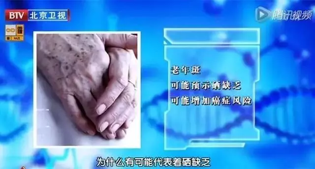硒是微量元素中的「胰島素」,搭配這8種食物,降糖更有效!