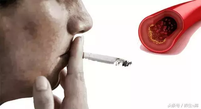 血脂高,臉先知,多食「3物」,多喝3水,少做3事,可防血栓!