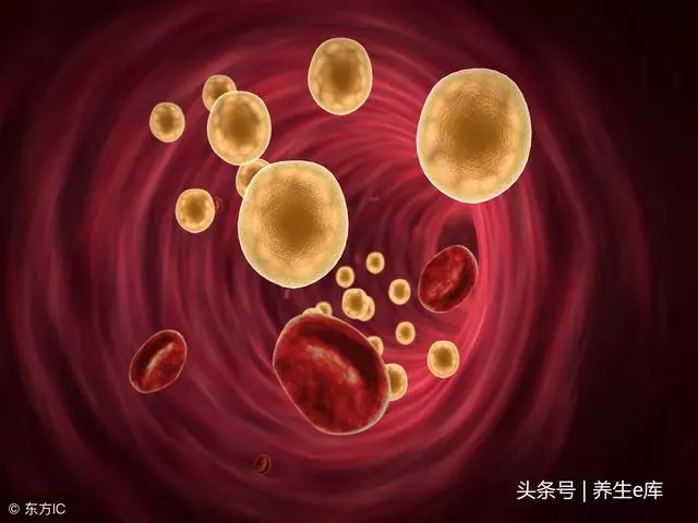 不論男女,臉上若有5種變化,小心高血脂!3樣食物再想吃也要忍忍