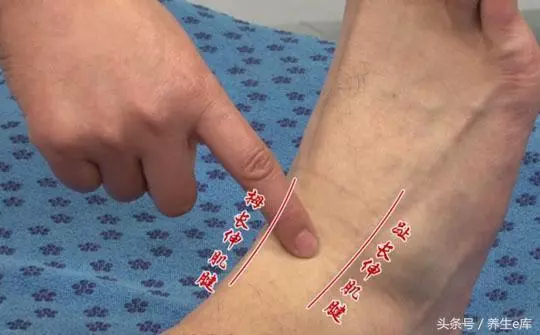 不論男女,臉上若有5種變化,小心高血脂!3樣食物再想吃也要忍忍