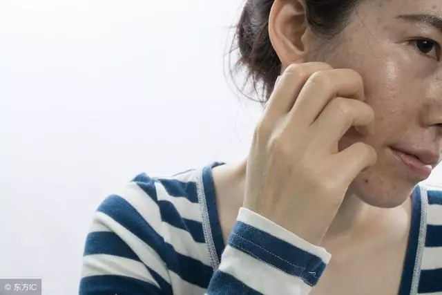 長了黃褐斑,不要急於求成,從內調理慢慢來