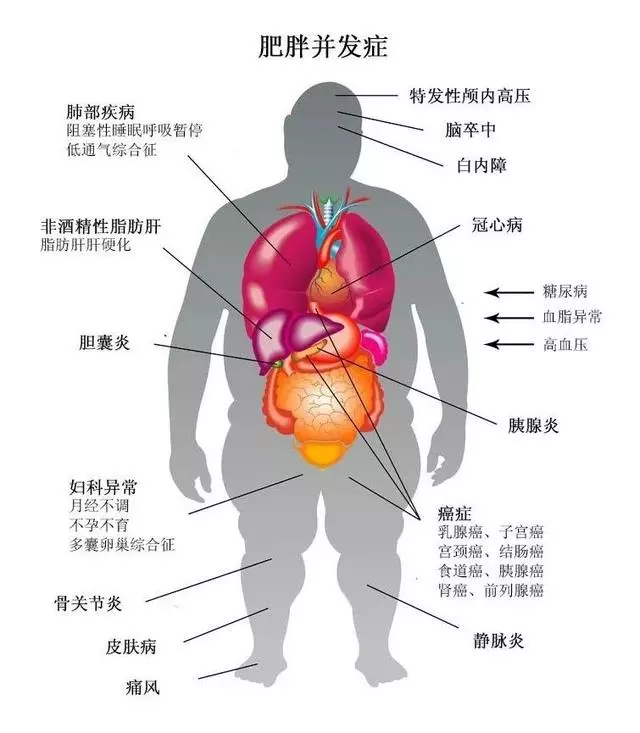日本肥胖率全球最低,而中國胖子越來越多,3個飲食習慣一定要學
