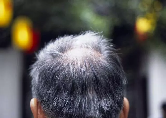 腎臟好不好看這6個標準就知道,占一個都很好!
