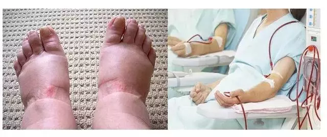再這么喝水,你將親手「毀掉」健康!4大誤區心中要有數