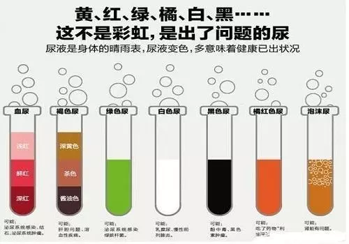 夜尿多,身體很可能在「暗示」5件事!醫生勸你別再忽視了!
