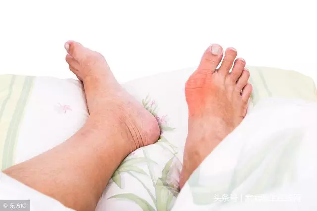睡前注意這4點,把尿酸悄悄排出去,痛風自然也不來了