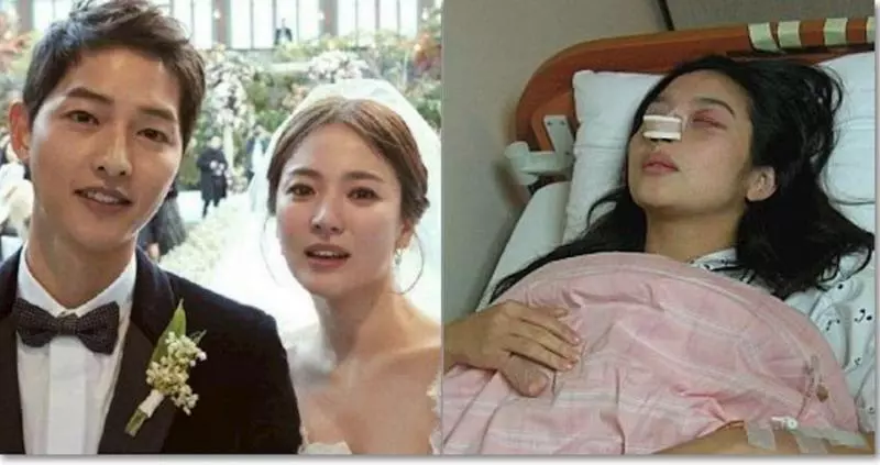 她結婚13天,被丈夫砍掉手指,懷孕被踢肚子,十五周孩子被踢掉!