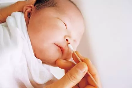 嬰幼兒鼻塞有什麼辦法?
