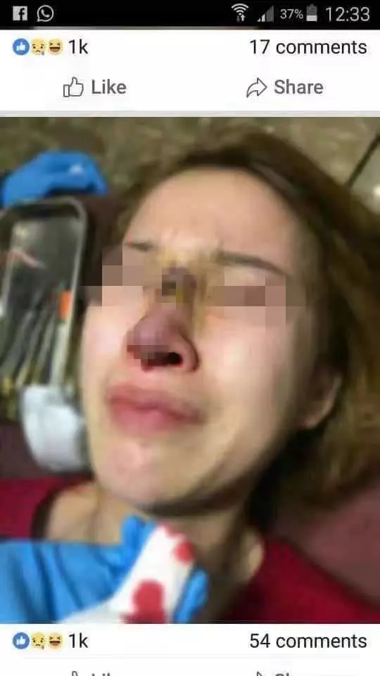 【霸氣岳父毒打女婿！】[影片] 毒販渣男教唆老婆去偷錢，因為老婆不肯，而把她打到進「ICU 急救室」！岳父：「你打我女兒
