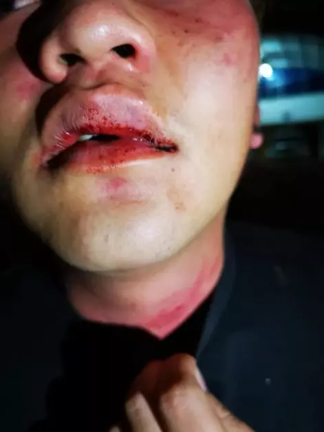 大便太久也被打!男子遭2惡霸痛毆