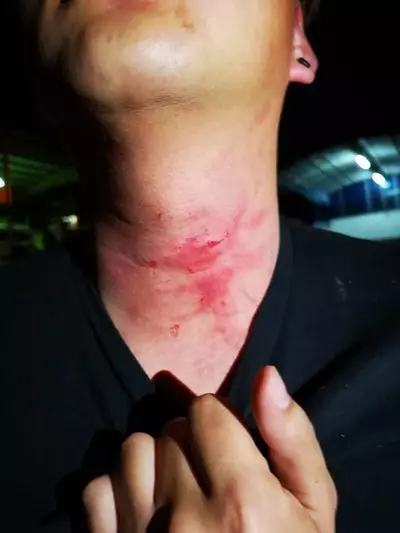 大便太久也被打!男子遭2惡霸痛毆
