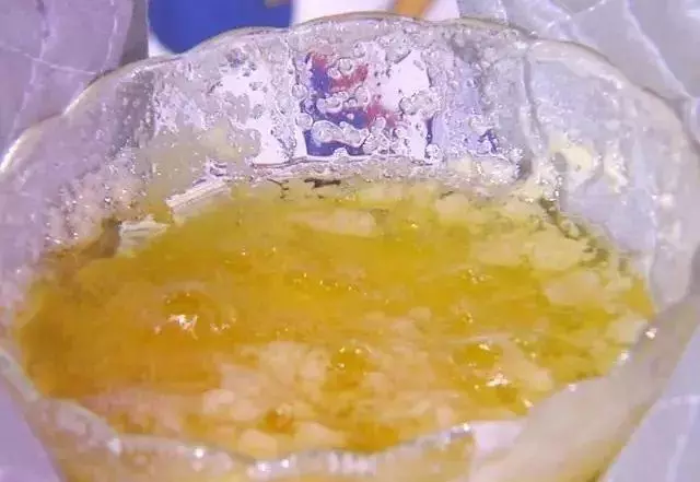 血管堵塞的真兇找到了!醫生建議:堅持3點,血管越來越通暢