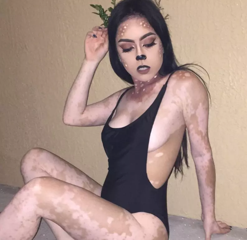 17個過去「一直被罵是醜女」的特別外貌女孩 她們現在向世界證明了自己的美