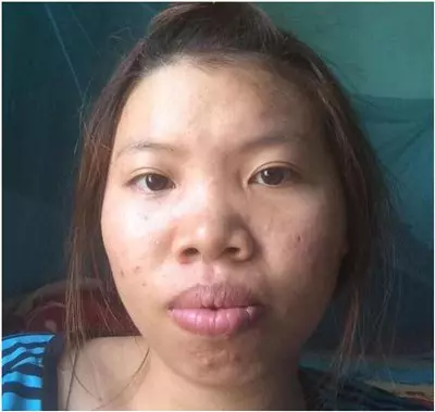 整得了容 改不了運 人工美女摔一跤打回原形
