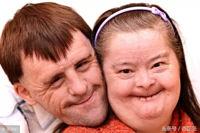 寶寶出生三個月被查出唐氏綜合,婆婆嫌手術貴不讓做,現在婆婆賴我家裡遺傳該怎麼辦?