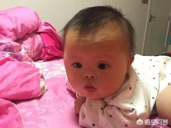 寶寶出生三個月被查出唐氏綜合,婆婆嫌手術貴不讓做,現在婆婆賴我家裡遺傳該怎麼辦?