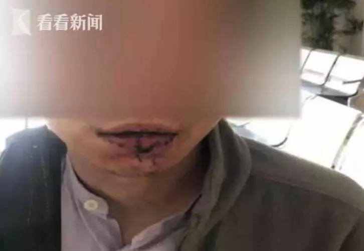 樓上酒醉鄰居太吵！一言不合衝上去「超親密傷害」 網友大笑被閃瞎：在一起啦！