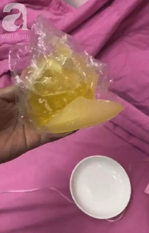 假胸空中爆裂! 承諾終身保修醫生失蹤 !