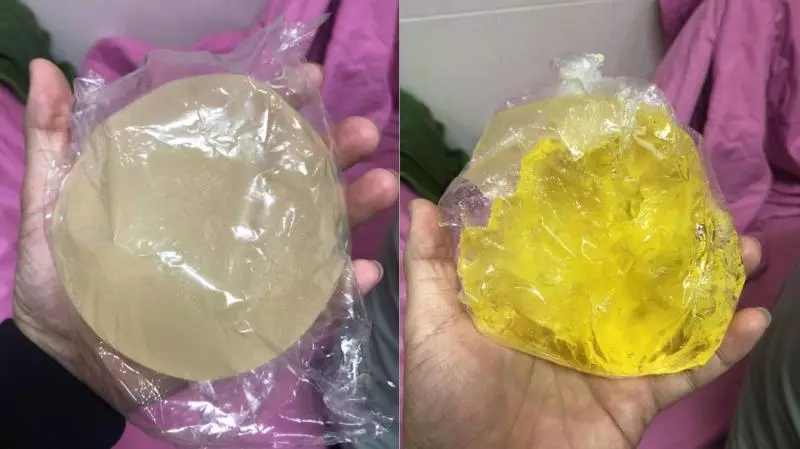 女星搭機假奶竟爆裂! 矽膠填充物變黃色硬塊