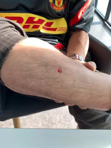 載客遭的士佬圍毆 Grab司機車損人傷